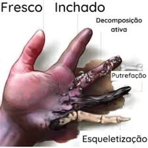 FENÔMENOS CADAVÉRICOS PARTE 2